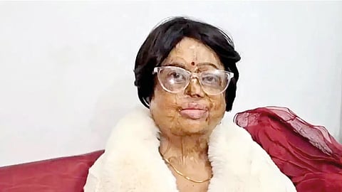 குரல்தான் அழகு...