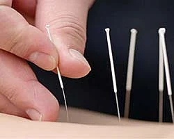 சர்க்கரை நோயாளிகளே... அக்குபஞ்சர் இருக்க கவலை ஏன்?