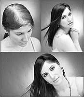 ஆயுள் காக்கும் ஆயுர்வேதம்: "முடி'யும் வளரும்!