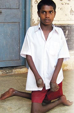 சிறப்பு ஆசிரியர் நியமிக்கப்படுவாரா?​​: தேர்வெழுத முடியாமல் அவதியுறும் 'மாற்றுத்திறன்' மாணவர்