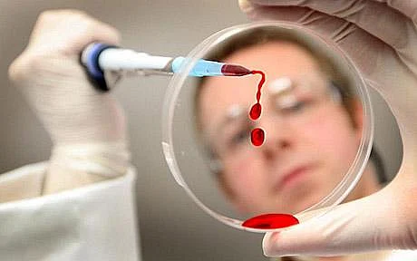 நாக்பூரில் மூன்று நாள்களில் 21 பேருக்கு பன்றிக் காய்ச்சல்