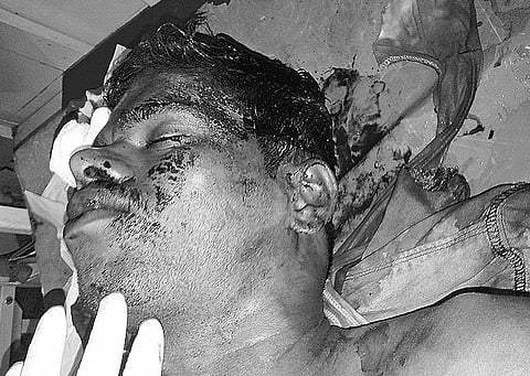 புழல் சிறையில் கைதிகள் - காவலர்கள் மோதல்: ஜெயிலர் உள்பட 4 பேர் காயம்; பணயக் கைதிகளாக இருவரை சிறைப் பிடித்தனர்