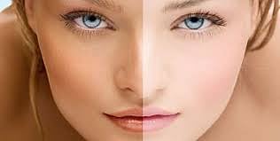 தேவையா  இத்தனை ஃபேர்னஸ் கிரீம்கள்?!