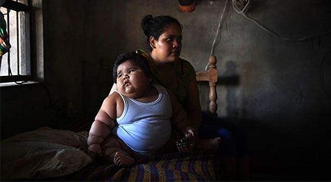 உலகின் அதிக எடையுள்ள குழந்தை லூயி மேனுவலின் தற்போதைய நிலை என்ன?