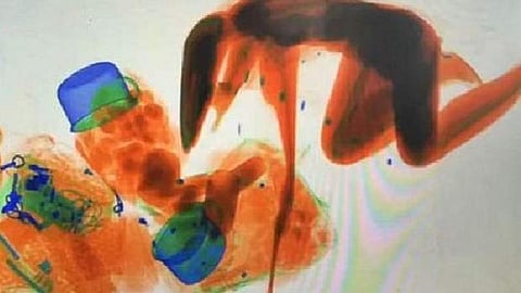 ஹேண்ட்பேக்குடன் எக்ஸ்ரே மிஷினில் குதித்த பெண்