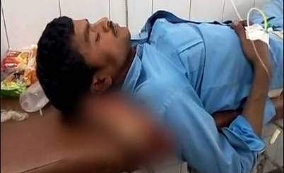 துண்டிக்கப்பட்ட காலை நோயாளிக்கு தலையணையாக்கிய மருத்துவமனை: மருத்துவர்கள் மீது நடவடிக்கை