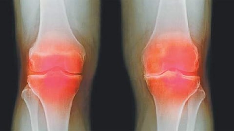 ஆயுள் காக்கும் ஆயுர்வேதம்: மூட்டுத் தேய்மானத்தைச் சரி செய்ய...!