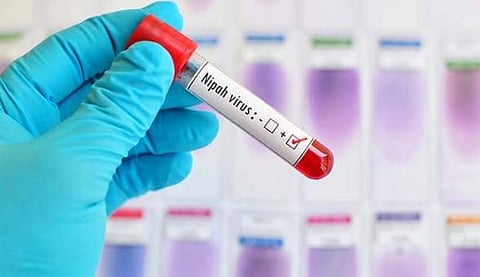 நிபா வைரஸ் எங்கிருந்து பரவியது? டெட் என்டில் மருத்துவ சோதனைகள்!