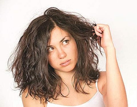 தலைமுடி பிரச்னை