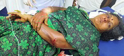 கோலமிட்டுக்கொண்டிருந்த பெண்ணுக்கு அரிவாள் வெட்டு