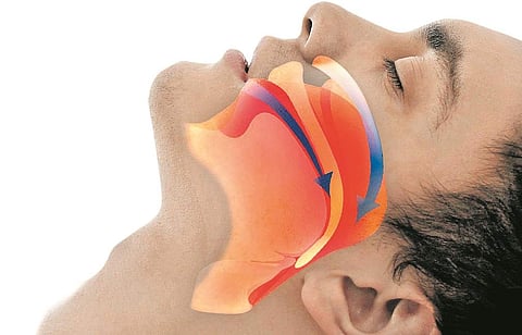 குறட்டை... மூச்சுத் திணறல்!