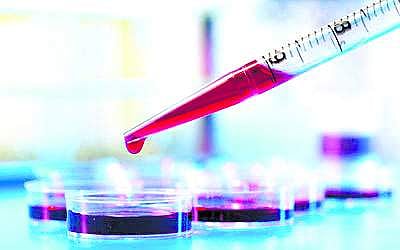 மருத்துவப் பரிசோதனை முடிவுகளில் 34% தவறானவை: ஆய்வில் அதிா்ச்சித் தகவல்