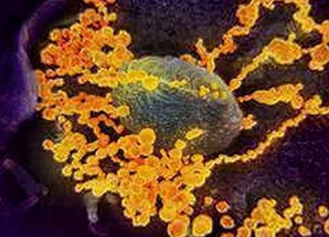 கரோனா வைரஸ்