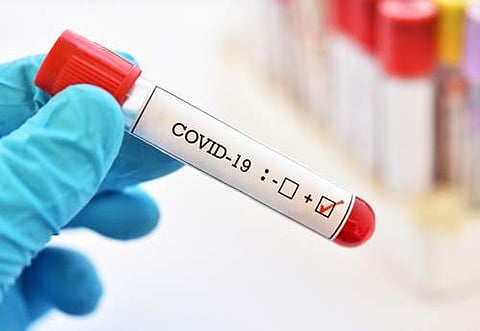 கரோனா வைரஸ் பாதிப்பால் உயிரிழந்தவர்களின் எண்ணிக்கை 4,972 ஆக உயர்வு