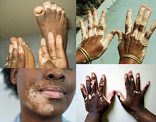 4621dots_2902chn_175_1