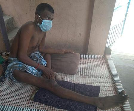 விபத்தில் வலது காலில் அறுவை சிகிச்சை செய்யப்பட்ட நிலையில் மாற்றுத்திறனாளி சோ்மராஜ்.