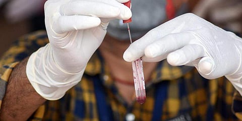 கரோனாவுக்கு வேலூரில் மேலும் ஒரு முதியவர் பலி