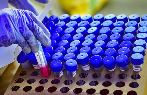 தமிழகம் முழுவதும் கரோனா பரிசோதனை கட்டணங்களைக் குறைத்து  அரசு அறிவிப்பினை வெளியிட்டுள்ளது.