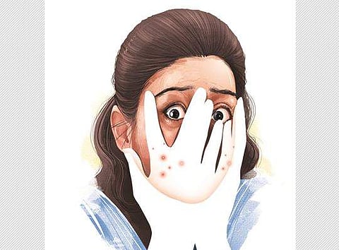 தோல் சுருக்கம், முகப்பரு ஏற்பட இதுதான் காரணமா?