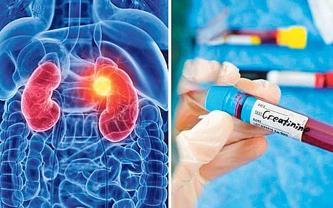 கிரியாட்டினின் அளவு அதிகமானால்...
