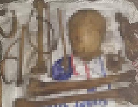 குப்பைத் தொட்டியில் மண்டை ஓடு, எலும்புக் கூடுகள்: சென்னையில் பரபரப்பு