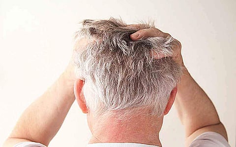 ஆயுள் காக்கும் ஆயுர்வேதம்: தலையில் புண், பொடுகு குணமாக..?