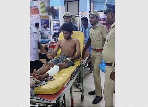 காஞ்சிபுரம் அரசு மருத்துவமனையில் சேர்க்கப்பட்டு  உள் நோயாளியாக சிகிச்சை பெற்று வரும் தனிப்படை போலீசார் சுட்டு பிடிக்கப்பட்ட கைதி அஜய். 