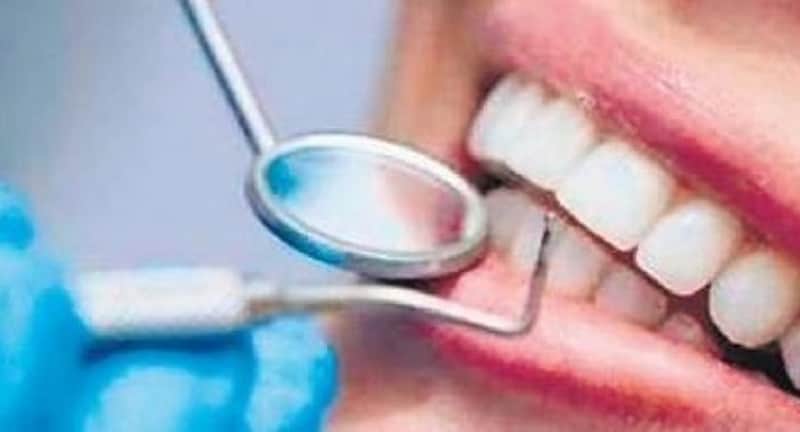 Myths and facts about dental health, dental cavities
