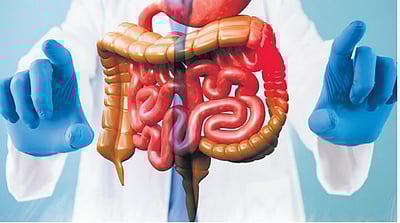 இளைஞர்களிடையே பெருங்குடல் புற்றுநோய் அதிகரிப்பு ஏன்? 