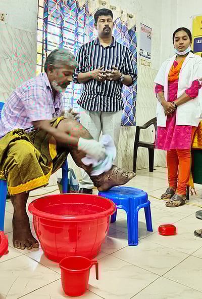 யானைக்கால் நோயாளிகளுக்கு 
வீக்கக் குறைப்பு மேலாண்மைப் பயிற்சி
