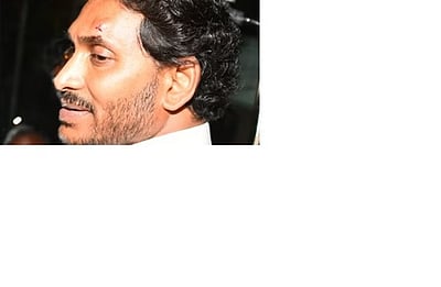 பிரசாரத்தில் கல்வீச்சு: ஆந்திர முதல்வா் காயம்