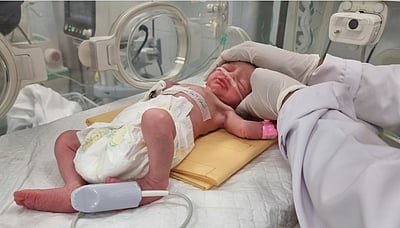 தெற்கு காஸாவில் அறுவைச்சிகிச்சை மூலம் உயிருடன் மீட்கப்பட்ட குழந்தை பலி