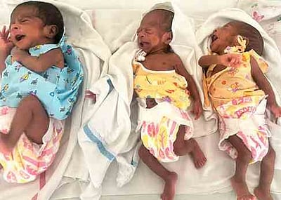 திருப்பூரில் பிரசவத்தில் பெண்ணுக்கு 3 குழந்தைகள் பிறந்தன