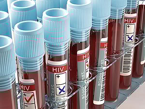 திரிபுராவில் 828 மாணவர்களுக்கு எச்ஐவி: அதிர்ச்சி தகவல்!