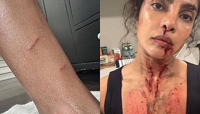 நடிகை பிரியங்கா சோப்ராவுக்கு என்னாச்சு? 