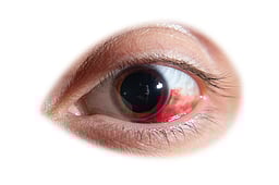 மக்களே எச்சரிக்கை! அதிகரிக்கிறது மெட்ராஸ் - ஐ!