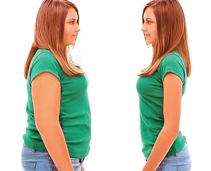 வளரிளம் பருவ உடற்பருமன் : தடுக்கும் வழிகள்!