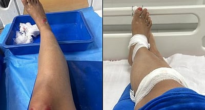 உங்கள் வாழ்க்கையை விரும்பினால், பைக் டாக்ஸியை பயன்படுத்த வேண்டாம்: பாதிக்கப்பட்ட பெண்!