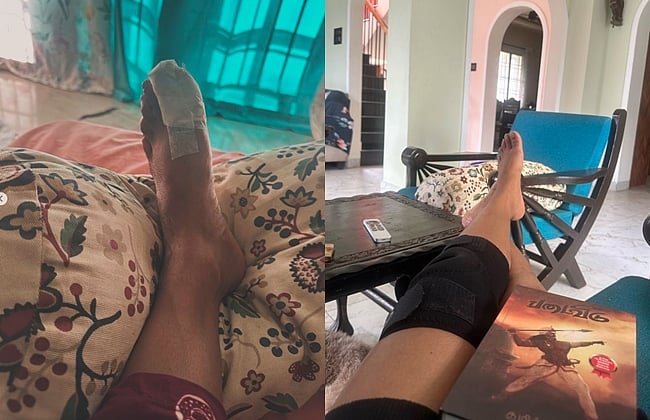 காலில் காயங்களுடன் சரண்யா