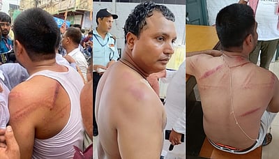 பிகாரில் காங்கிரஸ் தலைவர் மற்றும் தொண்டர்கள் மீது தடியடி!