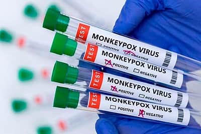 ஷார்ஜாவிலிருந்து திருவாரூர் வந்தவருக்கு குரங்கம்மை அறிகுறி?