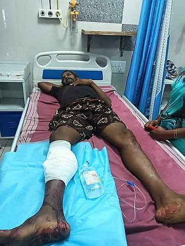 நாமக்கல் அருகே எருமப்பட்டியில் நாட்டுத் துப்பாக்கியால் சுட்டதில் ஒருவா் காயம்