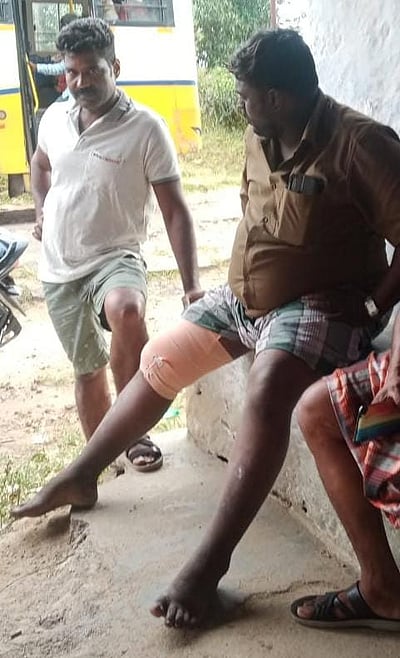 ஊத்து தேயிலைத் தோட்டப் பகுதியில் யானைத் தாக்கியதில் அரசுப் போக்குவரத்துக் கழக நடத்துனர் காயம்!