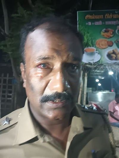 பட்டாசு வெடித்து எஸ்.ஐ. காயம்: அதிமுகவினா் 20 போ் மீது வழக்கு