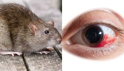 நோயாளியின் கண்ணைத் தின்ற எலி? மருத்துவர்கள் அலட்சியம்!