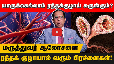 ரத்தக்குழாய் சுருங்குவதற்கு என்ன காரணம்? | மருத்துவர் பாலாஜியின் ஆலோசனைகள் | vascular diseases 