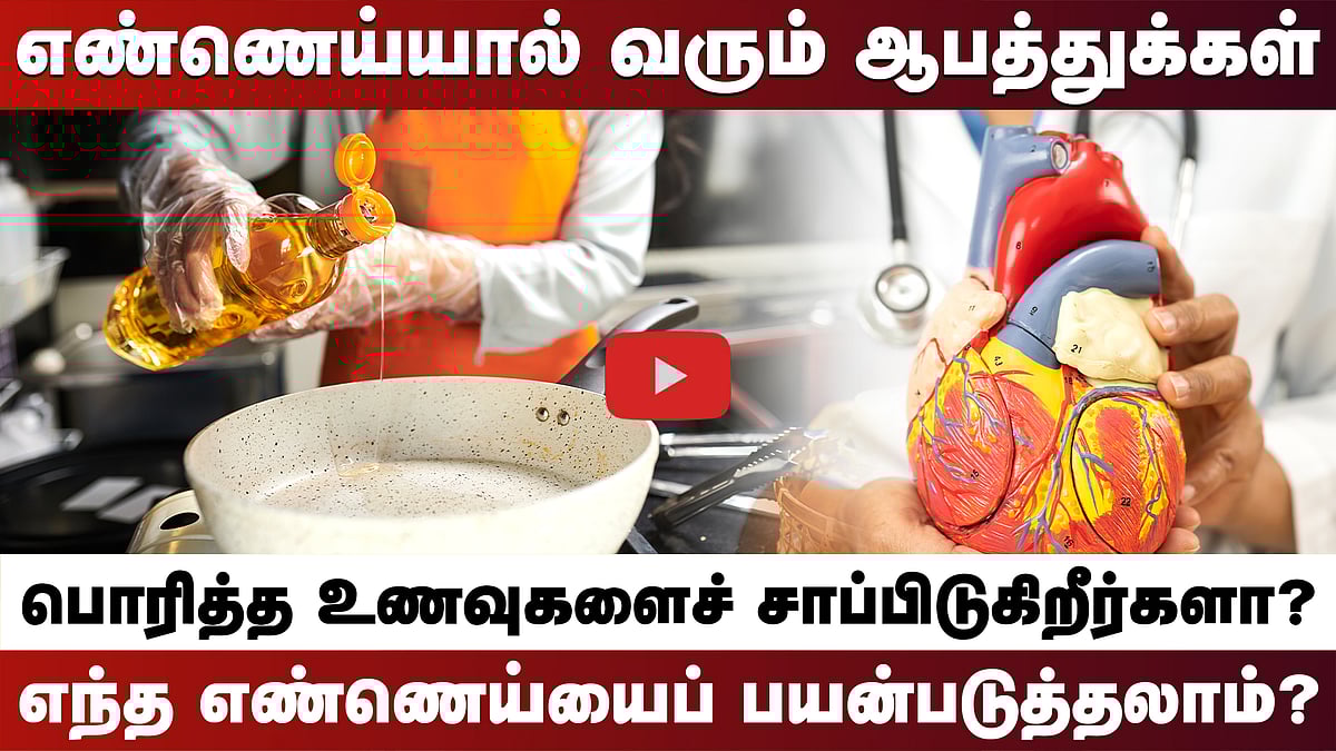 பொரித்த உணவுகளால் இவ்வளவு ஆபத்தா? எந்த எண்ணெய்யைப் பயன்படுத்தலாம்? | Fried Food | Health