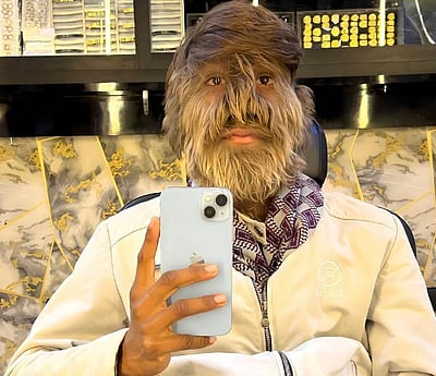 உலகிலேயே முகத்தில் அதிக முடிகள் கொண்ட நபர்! கின்னஸ் சாதனையில் இந்தியர்! 