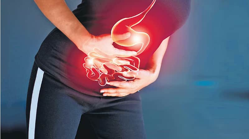 colon cancer