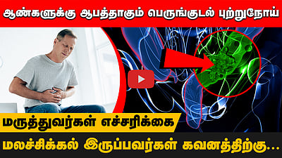 ஆண்களுக்கு ஆபத்தாகும் பெருங்குடல் புற்றுநோய்! எச்சரிக்கும் மருத்துவர்கள்! | Colon cancer |HealthTips